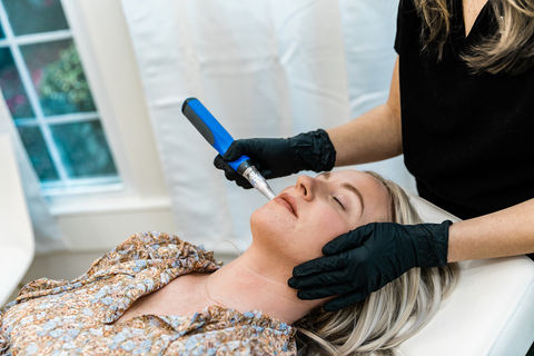 Microneedling