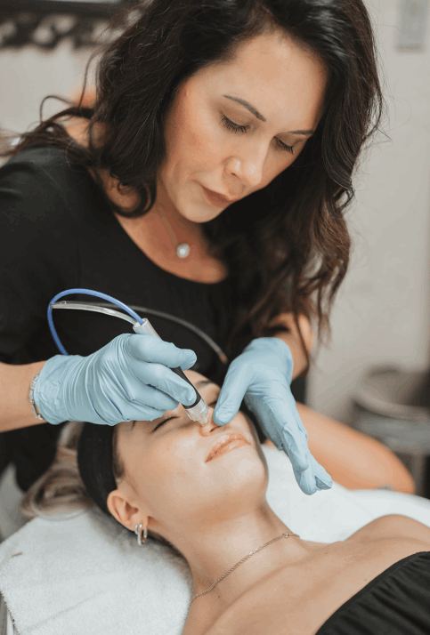 Hydrofacial/Hydrodermabrasion